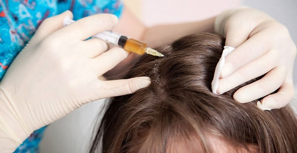 как проходит процедура мезотерапии для волос